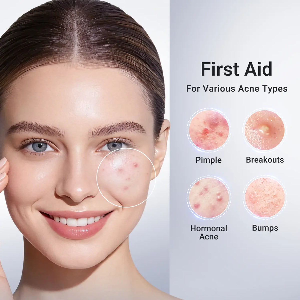 Dr.Leo Drying Lotion for Acne - Image 2
